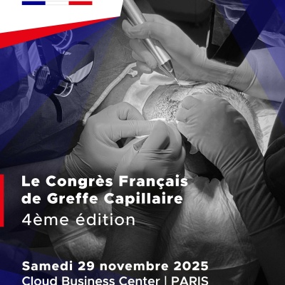 Focus sur l'alopécie féminine